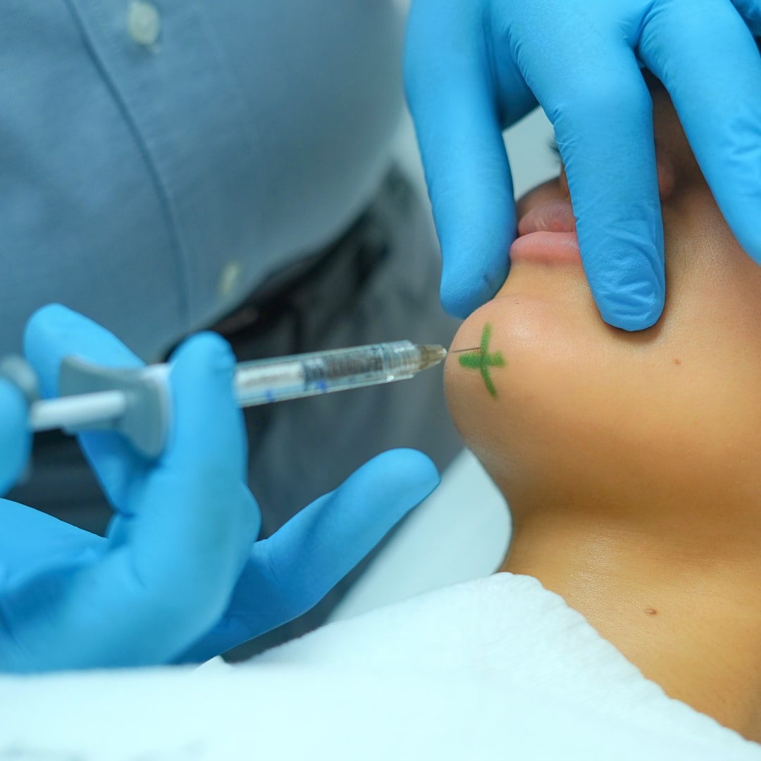 Çene Dolgusu - Dr. Ahmet Karaçam - Nişantaşı