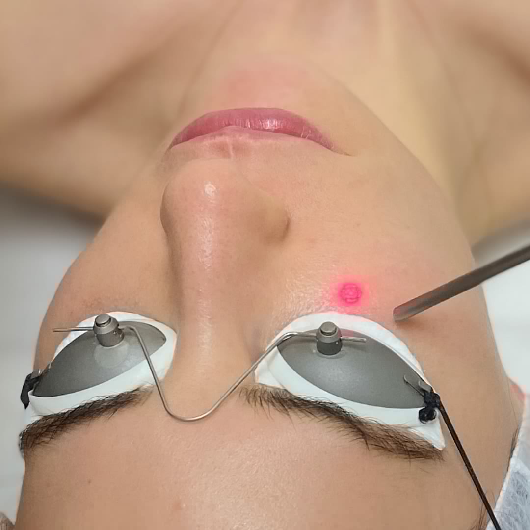 Cilt Yenileme - Dr. Ahmet Karaçam - Nişantaşı