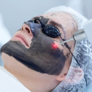 Karbon Peeling - Dr. Ahmet Karaçam - Nişantaşı