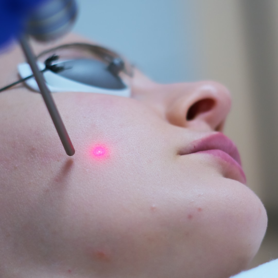 Lazerle Leke - Dr. Ahmet Karaçam - Nişantaşı