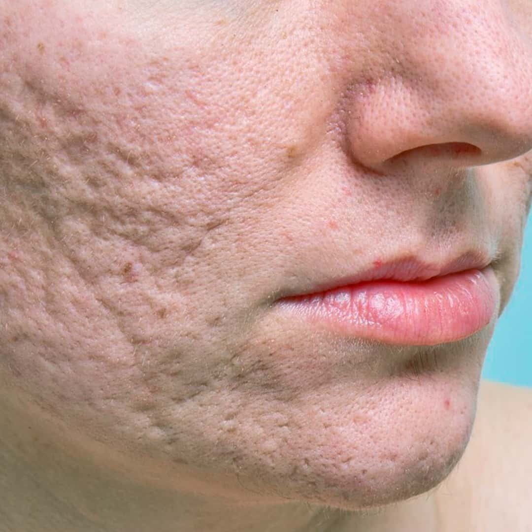 PB Serum High - Dr. Ahmet Karaçam - Nişantaşı