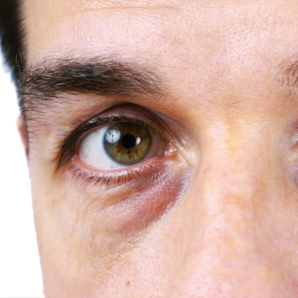 PB Serum Low - Dr. Ahmet Karaçam - Nişantaşı