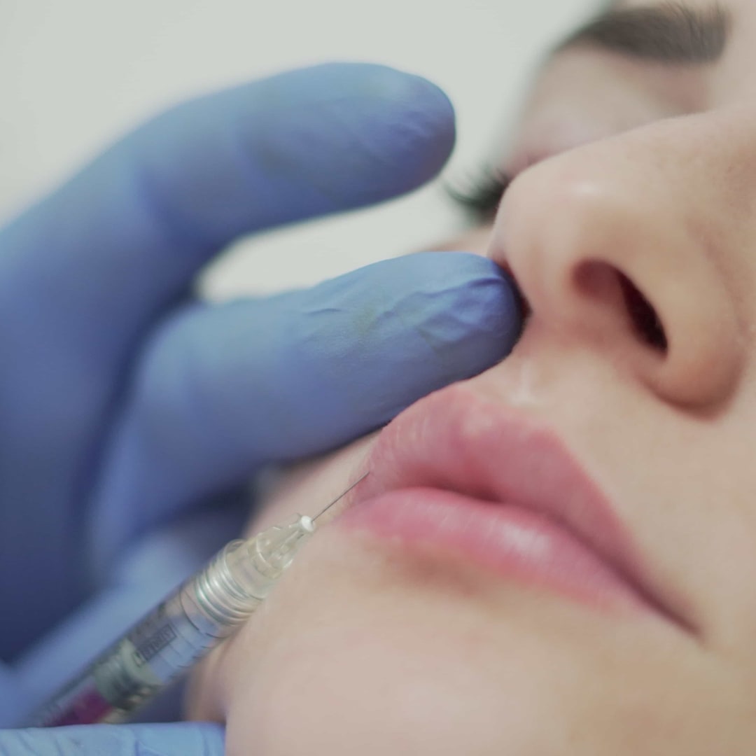 Russian Lips - Dr. Ahmet Karaçam - Nişantaşı