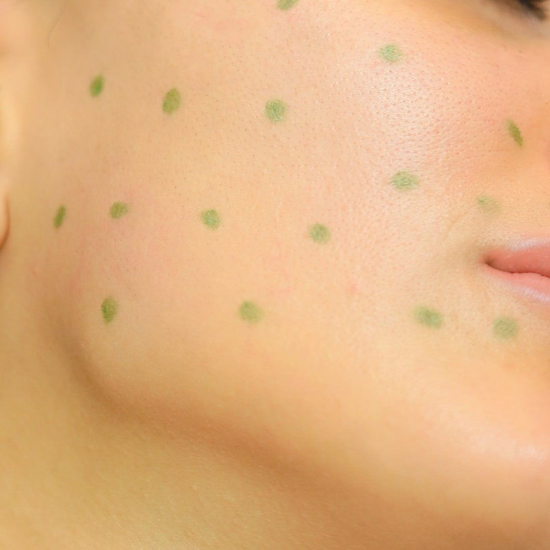 Somon DNA - Dr. Ahmet Karaçam - Nişantaşı