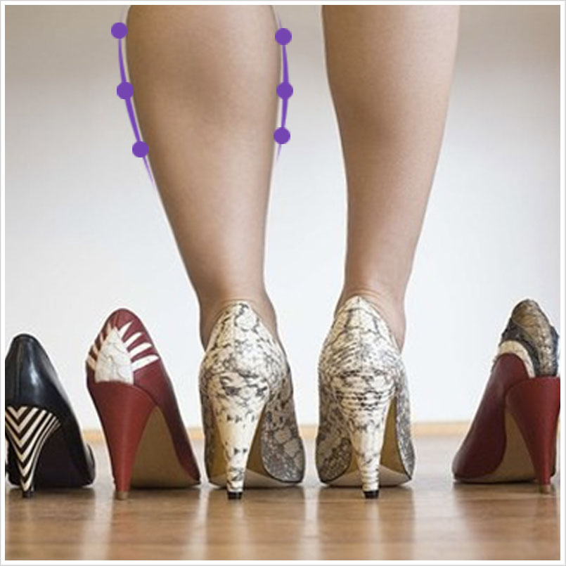 Bacak İnceltme - Dr. Ahmet Karaçam - Nişantaşı