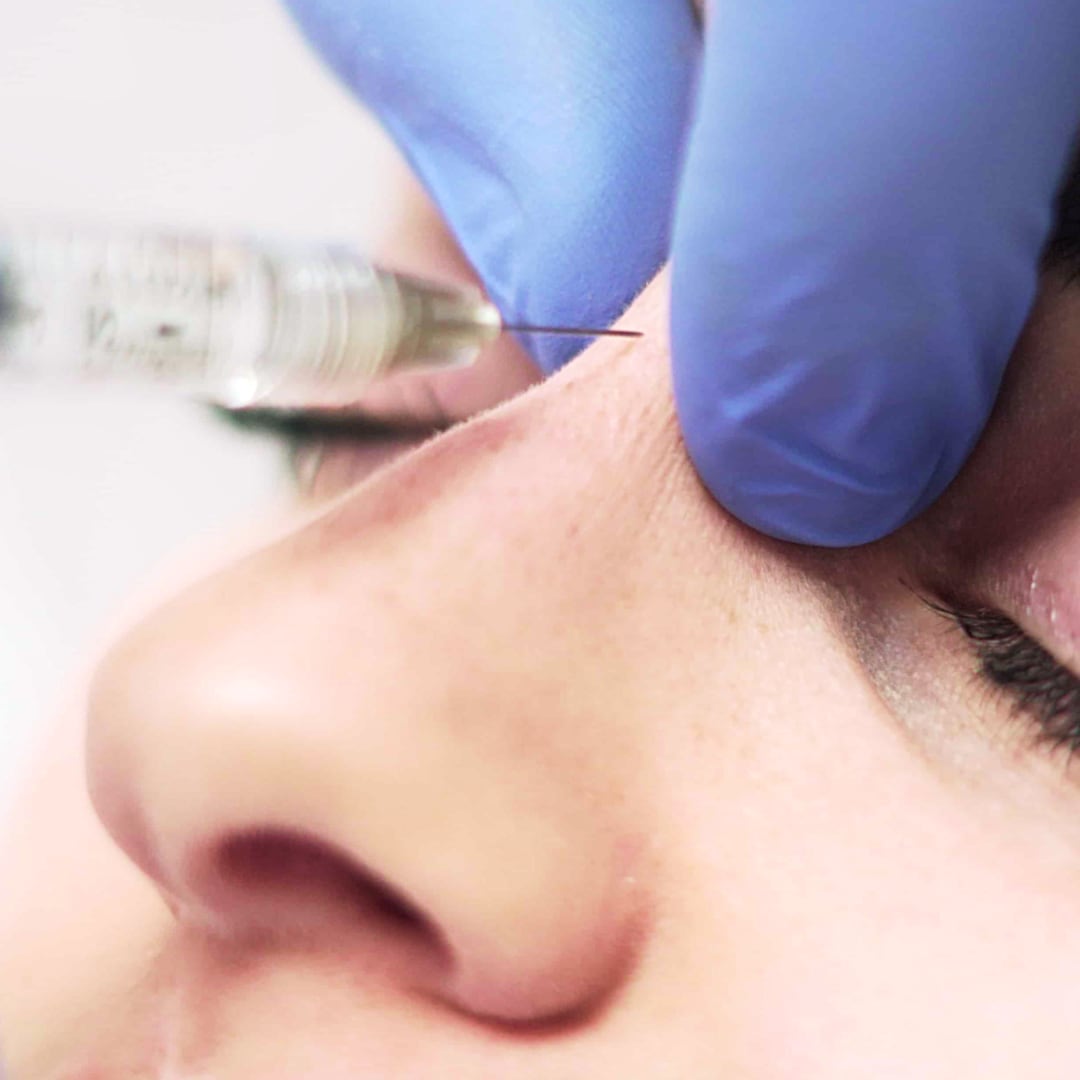 Burun Dolgusu - Dr. Ahmet Karaçam - Nişantaşı