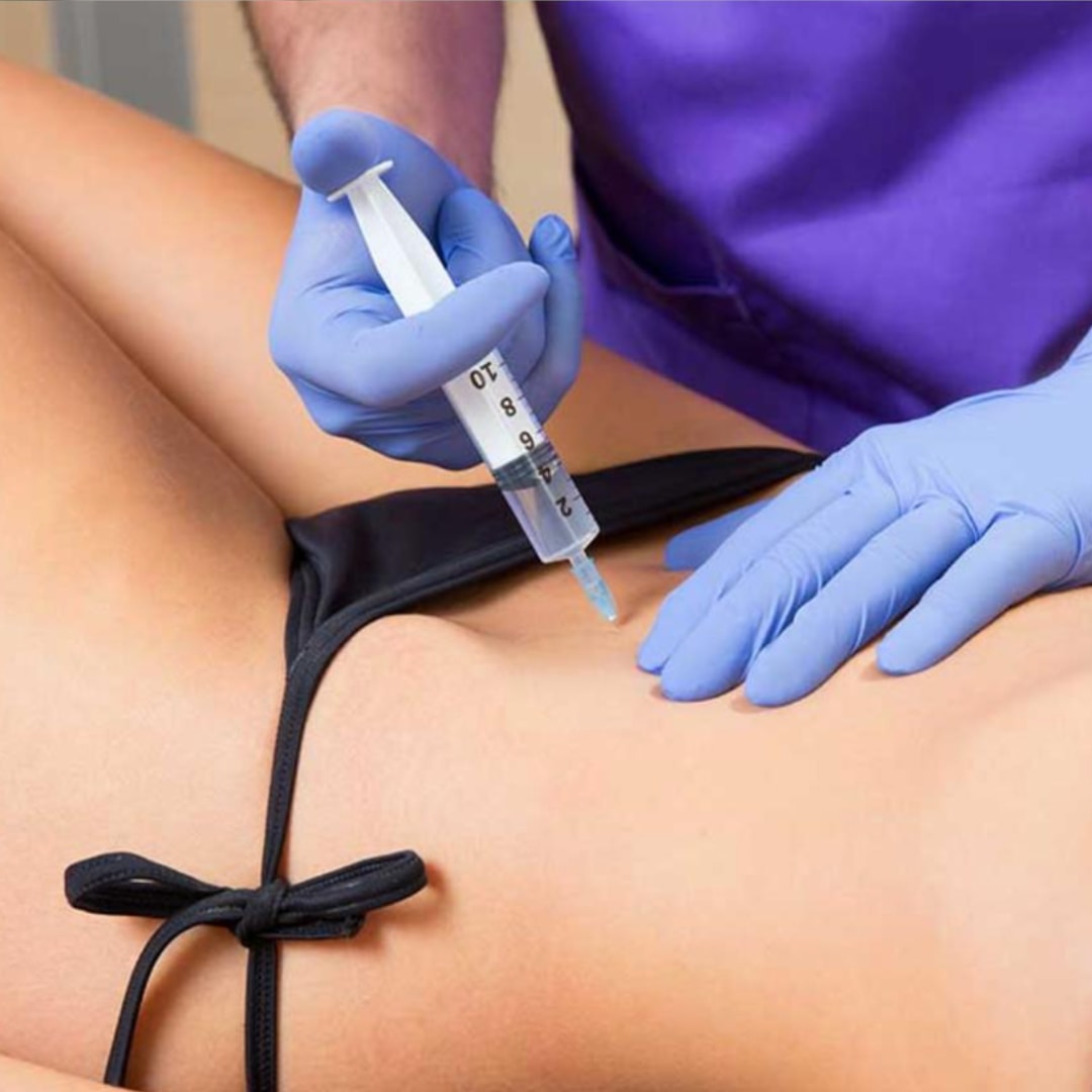 Enzimatik Lipoliz - Dr. Ahmet Karaçam - Nişantaşı