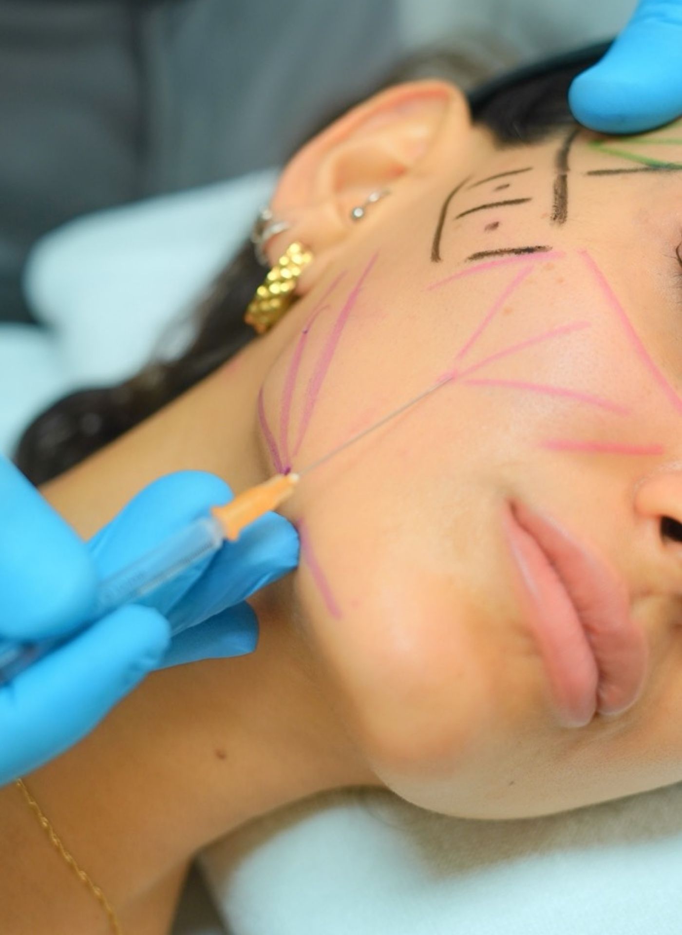 Medikal Uygulamalar - Dr. Ahmet Karaçam - Nişantaşı