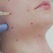 Kök Hücre - Dr. Ahmet Karaçam - Nişantaşı