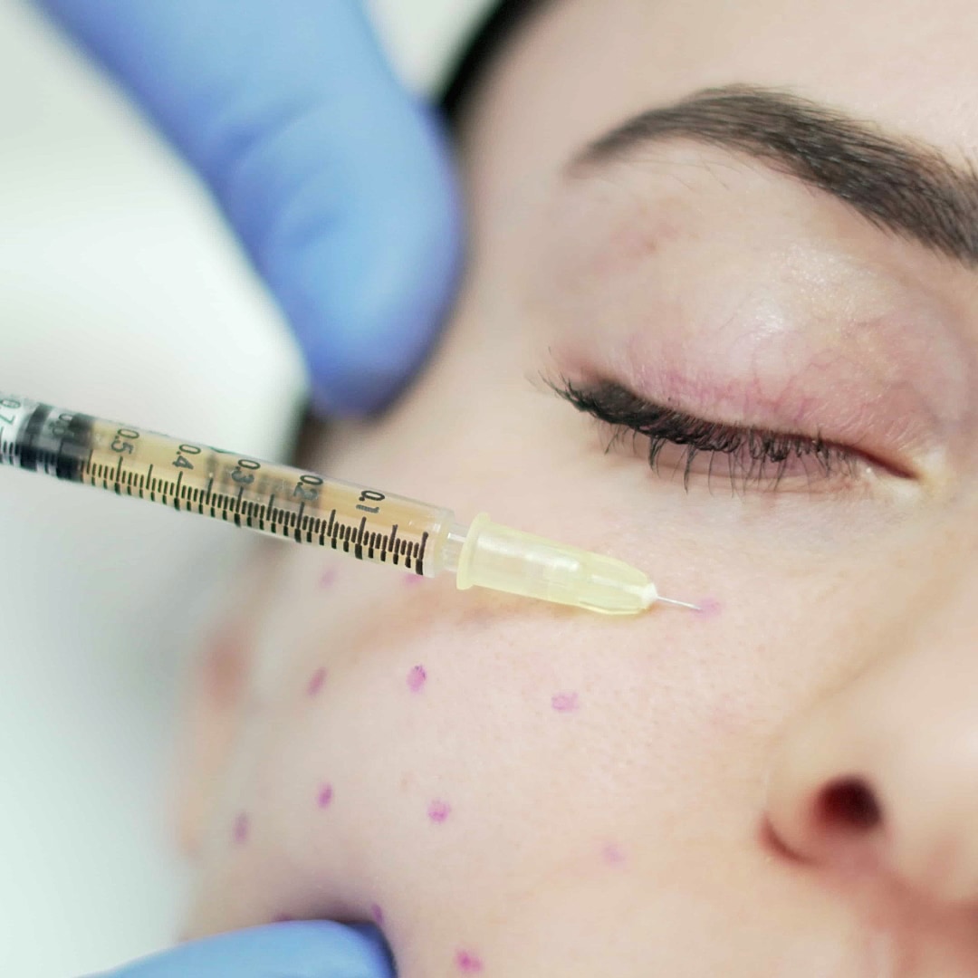 Mezoterapi - Dr. Ahmet Karaçam - Nişantaşı