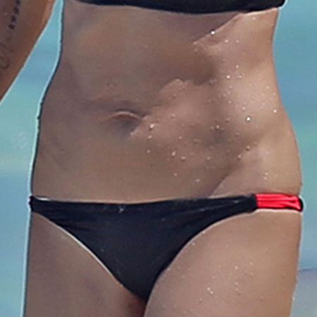 Velashape - Dr. Ahmet Karaçam - Nişantaşı