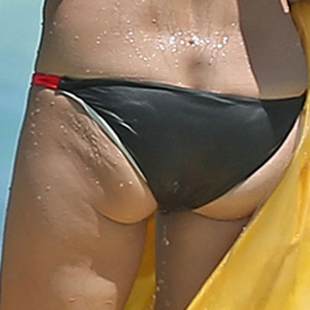 Velashape - Dr. Ahmet Karaçam - Nişantaşı